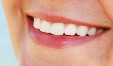 Smiling woman with veneers at Arkansas Family Dental Clinic